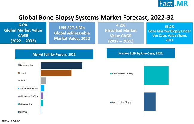 Bone biopsy systems market forecast by Fact.MR