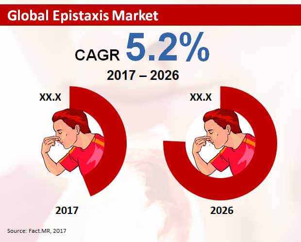 epistaxis market