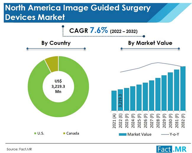 NA Image Guided Surgery Devices Market forecast analysis by Fact.MR